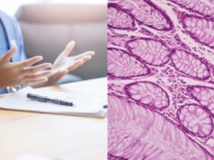 Oncología e innovación en España: un acceso desigual y tardío