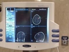 Cómo la neuronavegación revoluciona la cirugía cerebral y de columna