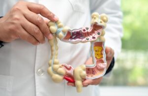 La prevención y el cribado, claves frente al cáncer de colon en España