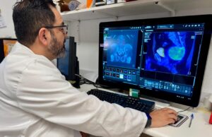 El Hospital Doctor Peset introduce la cirugía radioguiada y molecular para la localización de tumores en la columna vertebral