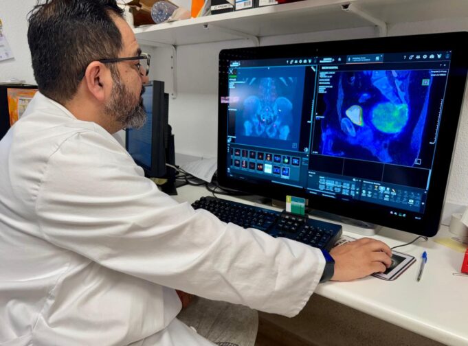El Hospital Doctor Peset introduce la cirugía radioguiada y molecular para la localización de tumores en la columna vertebral
