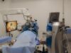 Las 5 preguntas más frecuentes sobre la cirugía refractiva ocular