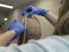 El hospital 12 de Octubre en Madrid participa en ensayo fase 3 sobre tratamiento combinado del glioblastoma