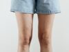 Piernas hinchadas tras el verano: cuándo las varices deben llevarnos al médico