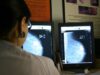 Más de 311,000 mujeres examinadas en la Comunitat Valenciana gracias al programa de cribado de cáncer de mama